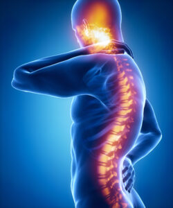 Poor posture pain in sacral and cervical region concept